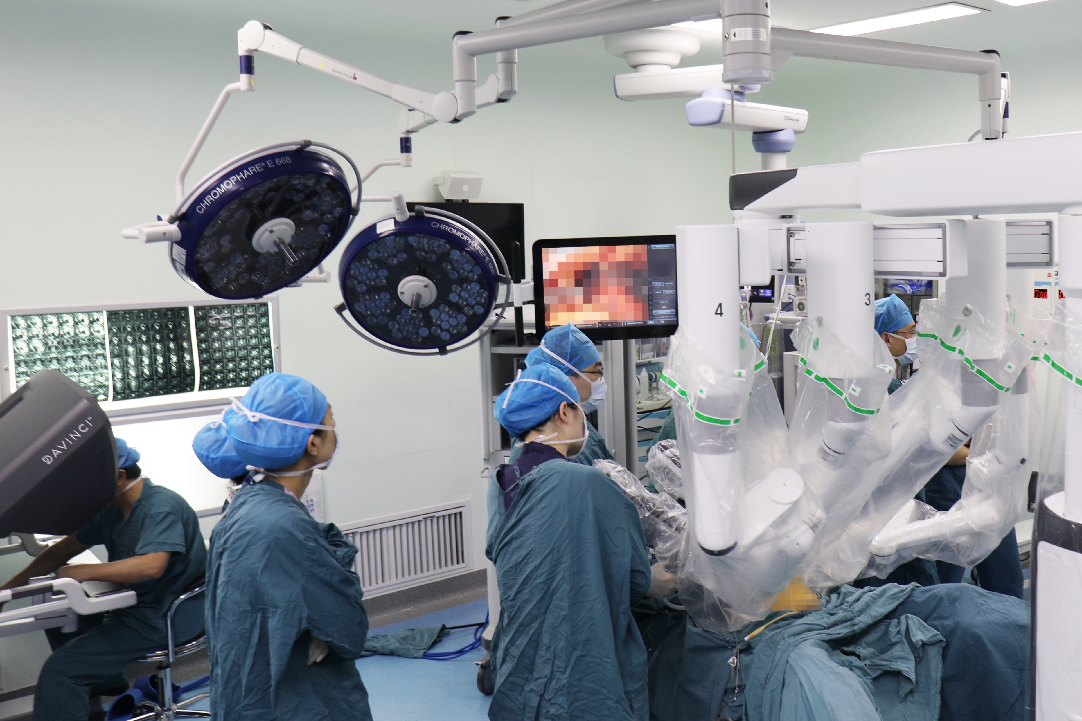 武汉市第一医院首台机器人外科手术进行中.jpg