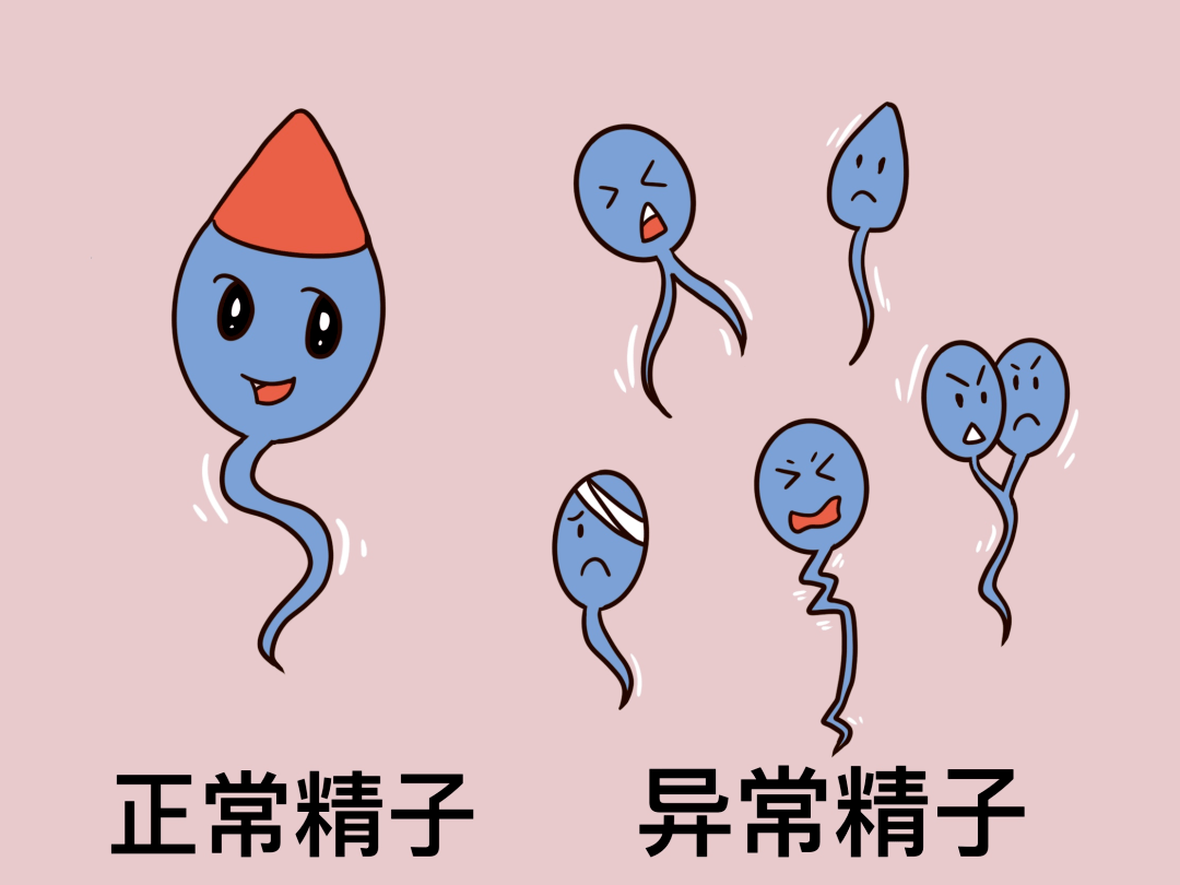 精子畸形.png